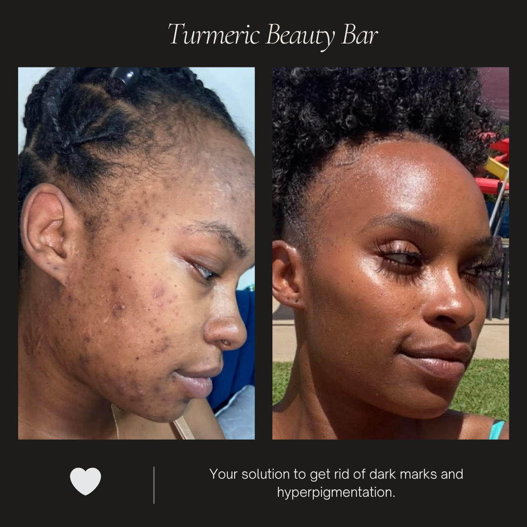 Turmeric Beauty Bar